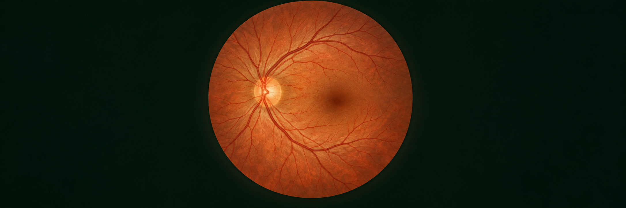 Imagen ilustrativa de un fondo de ojo con retina, disco óptico y vasos sanguíneos.